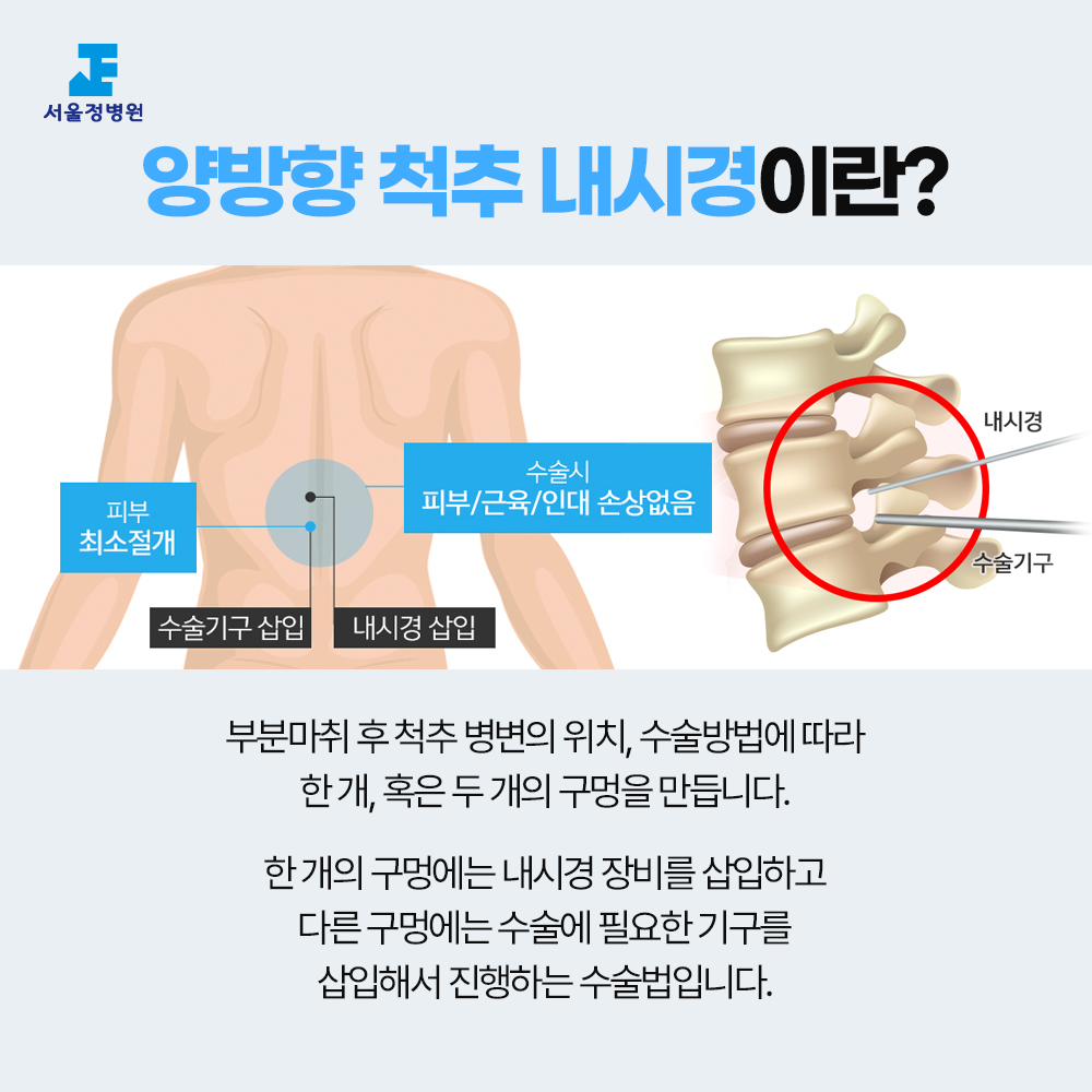 서울정병원 중랑구 신경외과