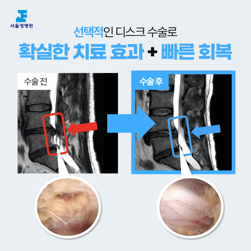 서울정병원 중랑구 신경외과