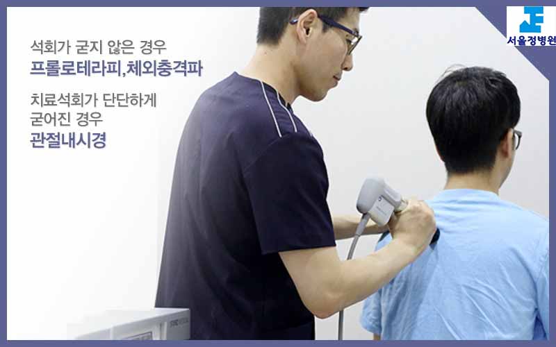 서울정병원 어깨통증 석회화건염
