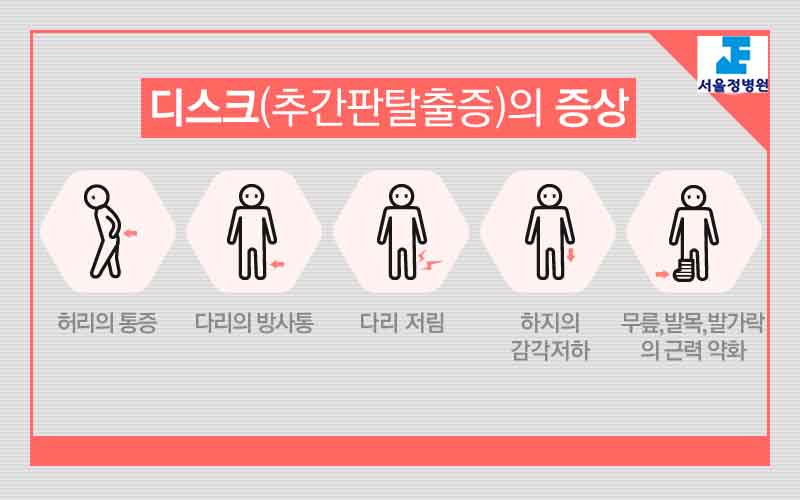 서울정병원 중랑구 정형외과 허리통증