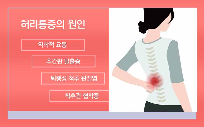 서울정병원 중랑구 정형외과 허리통증
